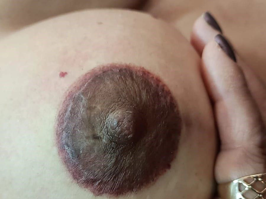 Depois — Correção de cor e desenho, reconstrução estética de aréola